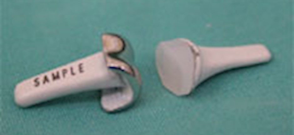 Small Joint Replacements